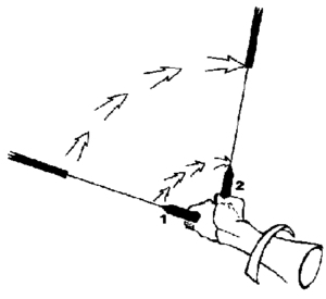 Schema de la prise en pronation